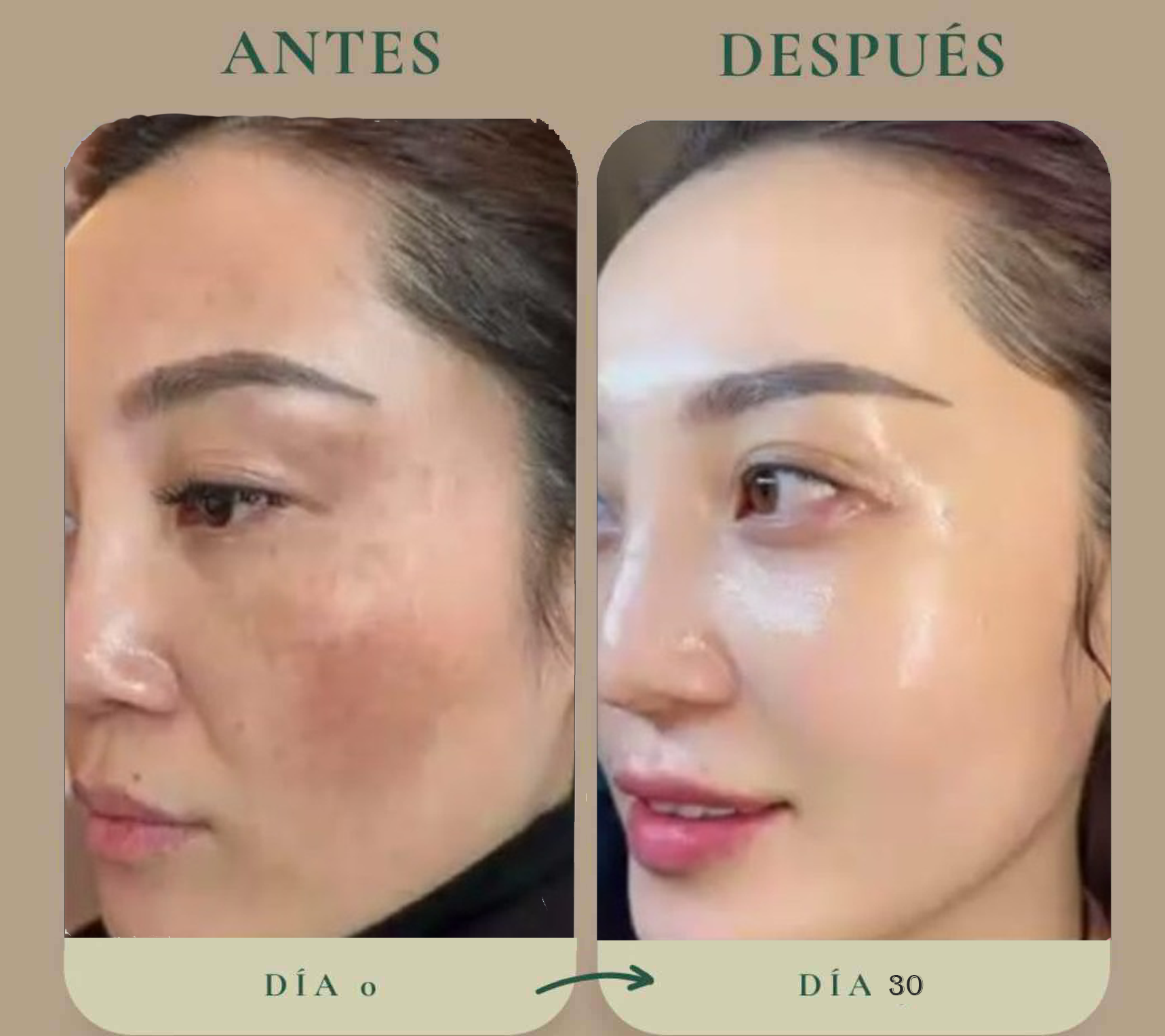 Antes y después — caso 4