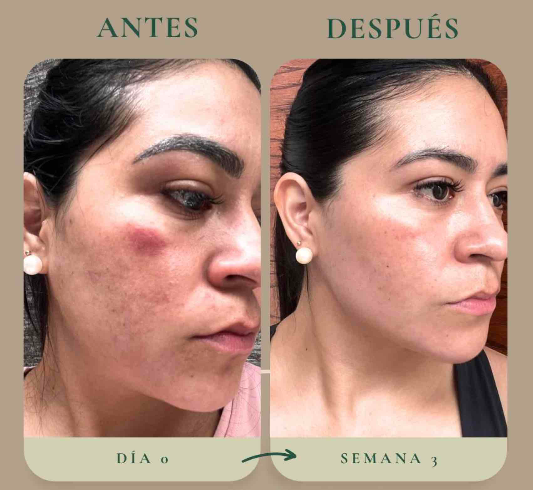 Antes y después — caso 1